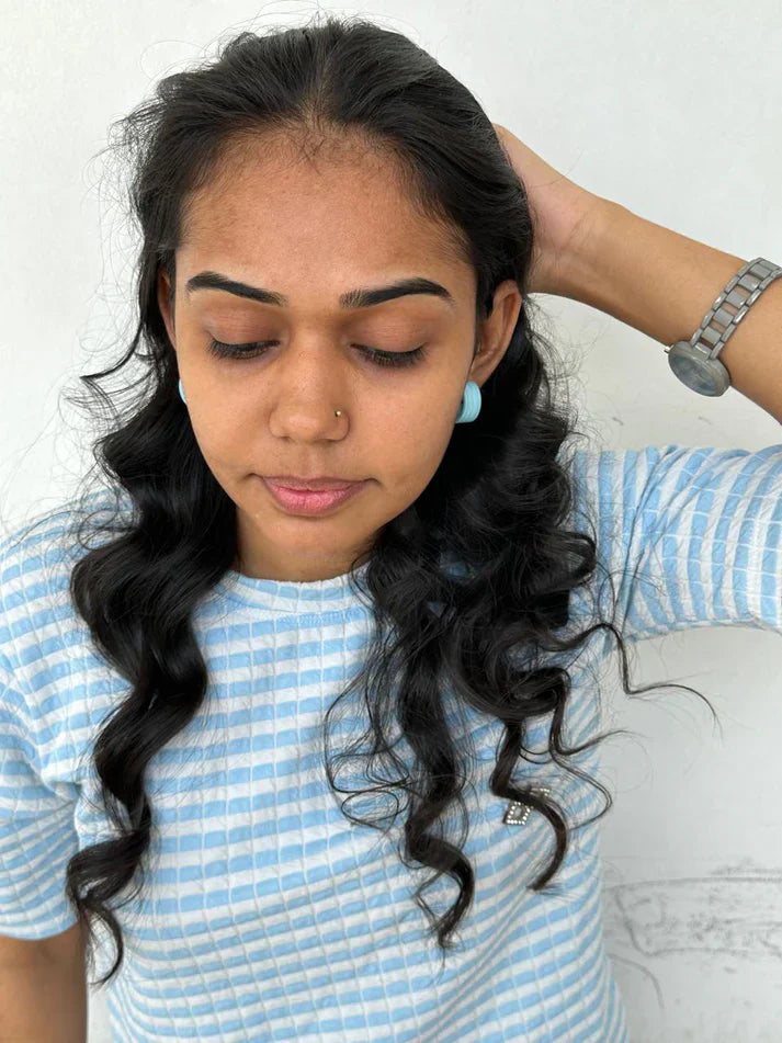 FRONT HAIRLINE PATCH