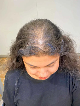 Magic Clip-on Hair Patch